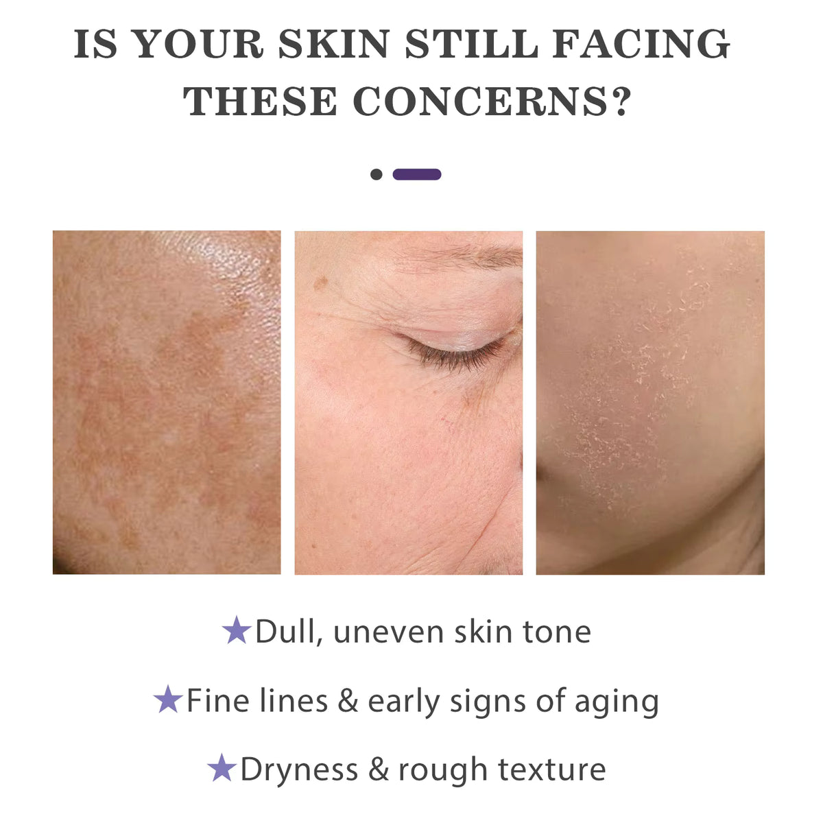 NAD+PDRN Lifting-sil Essence